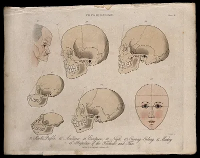A profile of an old mentally disabled man, skulls of various races, skulls of a monkey and an orangutan, and a perfect, diagrammed human face; demonstrating the methods of physiognomy