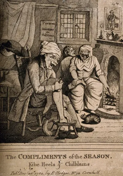 A quack doctor treating her patient's chilblains
