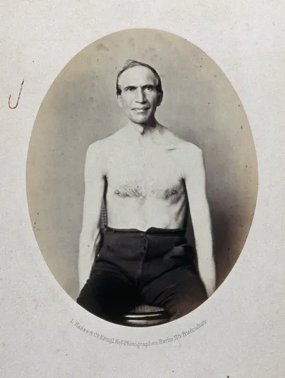 A seated man, bare-chested and viewed from the front