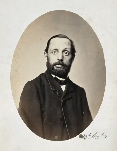 A seated man, head and shoulders; the right side of his face is different from the left