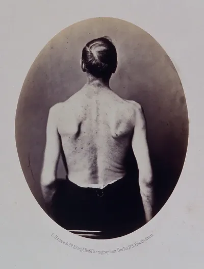 A seated man, viewed from behind, unclothed to the waist