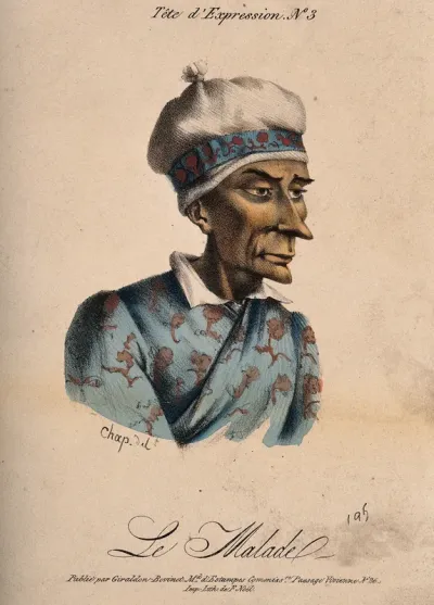 A sick man. Coloured lithograph by Chap (?)
