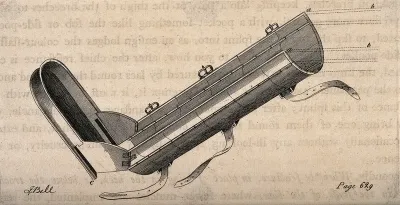 A splint for a broken limb