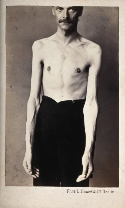 A standing man, naked to the waist