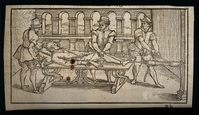 A surgeon and two assistants using pulleys and ropes to aid traction for manipulating the body of a male patient