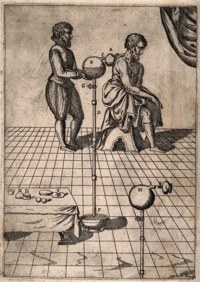 A surgeon applying the method of cupping to a patient