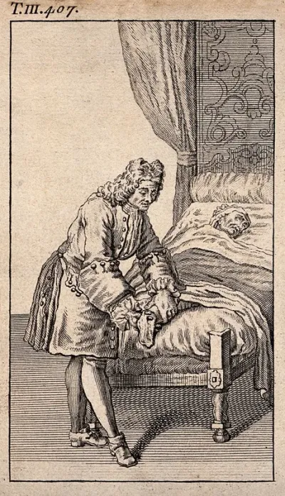 A surgeon dressing the stump of a patient's recently amputated leg