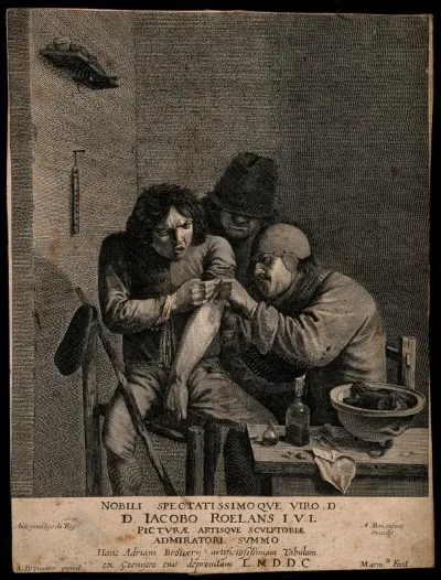 A surgeon dressing the wound of a grimacing patient