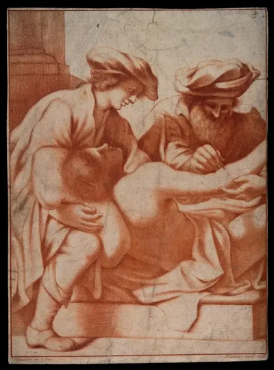 A surgeon opening an abcess on the arm of a reclining man who is leaning on the lap of the surgeon's assistant