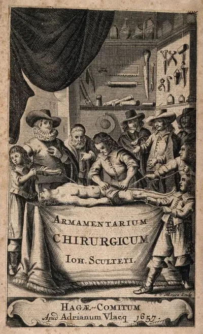 A surgeon setting a leg with the aid of three assistants, observed by onlookers, in front of walls on which various surgical instruments are arranged