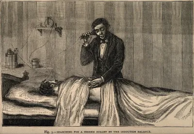 A surgeon using an electrical device to externally track a hidden bullet inside a patient's body