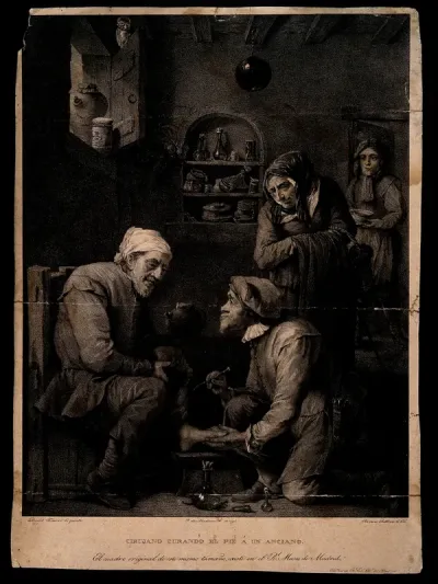A surgeon (whose features resemble a monkey's) is treating the foot of an elderly man, his concerned wife observes the scene and an assistant enters the room with a bowl
