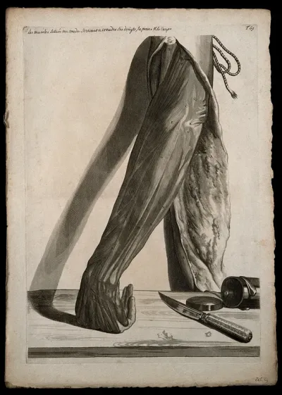 A suspended lower arm from which the skin and fatty layer has been removed to reveal the muscles