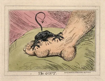 A swollen and inflamed foot: gout is represented as an attacking demon