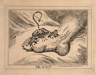 A swollen and inflamed foot: gout is represented by an attacking demon