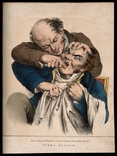 A tooth-drawer extracting a tooth from a grimacing patient