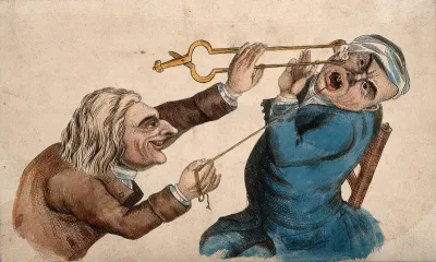 A tooth-drawer frightening his patient with a hot coal causing him to pull away violently and extract a tooth