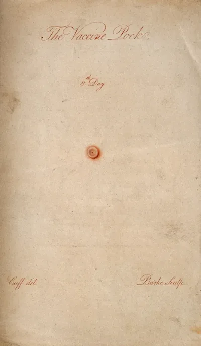 A vaccinated pustule