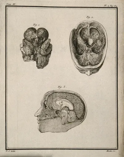A wax model of the brain and head (figs 1-2) by F