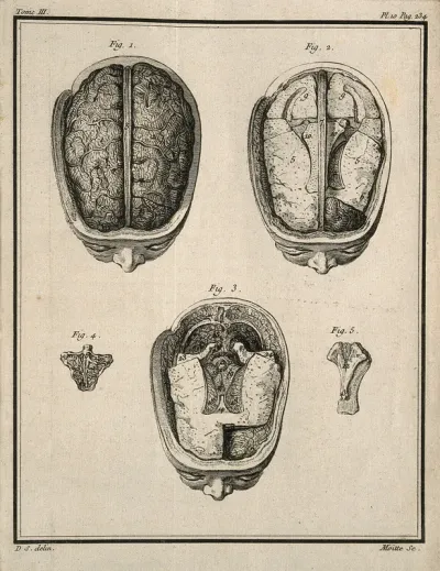 A wax model of the brain made by F