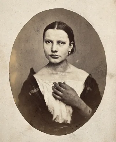 A woman, head and shoulders; she has a bump on her right shoulder