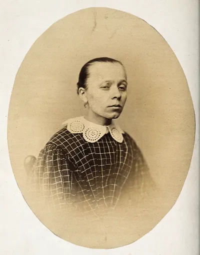 A woman, head and shoulders, viewed from the front; her eyelids are uneven