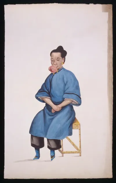 A woman (Kwo Pe) with a tumour hanging from her upper lip