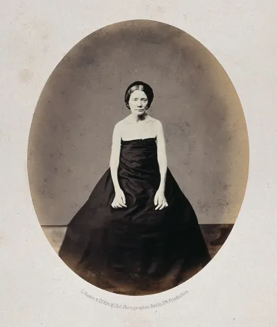 A woman standing, viewed from the front, her shoulders and arms are unclothed and she has misshapen fingers
