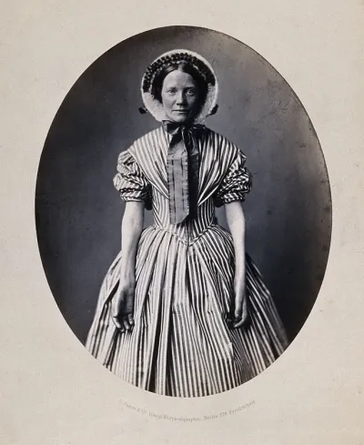A woman standing, viewed from the front, wearing striped dress and bonnet, hands and forearms revealed