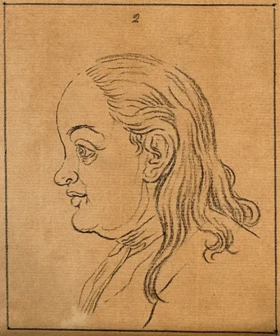 A woman whose face exemplifies the phlegmatic temperament