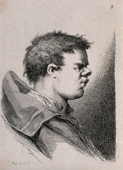 A young man in caricature, the features of his face bunched up into a small area