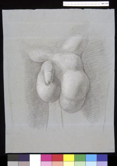 Abdominal tumor next to genitals