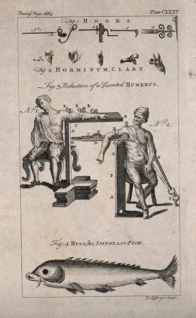 Above, surgical instruments and apparatus to cure a fractured humerus; below, Huso, the Isinglass fish