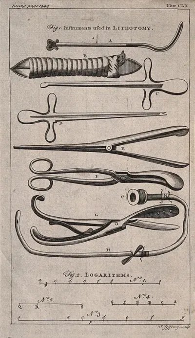Above, surgical instruments used in lithotomy; below, logarythms