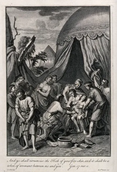Abraham and his men begin to circumcise themselves