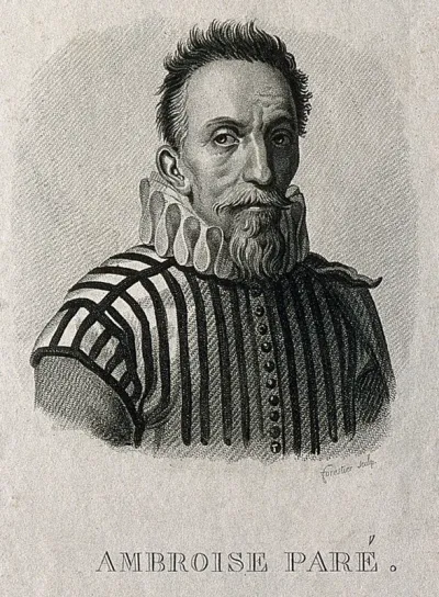 Ambroise Paré. Stipple engraving by C.A. Forestier, ca. 1823