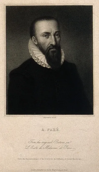Ambroise Paré. Stipple engraving by W. Holl