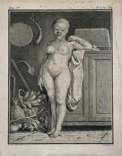 An albino woman of African descent, with white instead of black skin