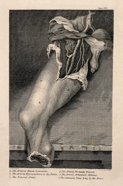 An amputated leg with dissected thigh, lettered for key
