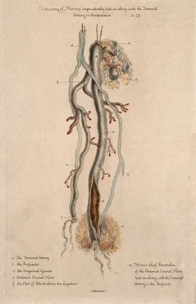 An amputated nerve and artery, lettered for key
