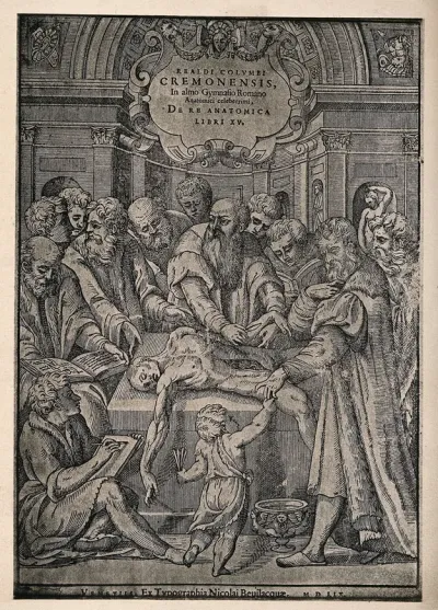 An anatomical dissection by Realdus Colombus, attended by onlookers