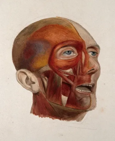 An écorché head of a man: three-quarter view, showing the right-hand side of the head dissected, and the left-hand side undissected