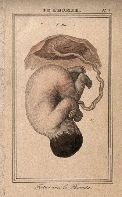 An eight month old foetus, shown attached to the placenta by the umbilical cord