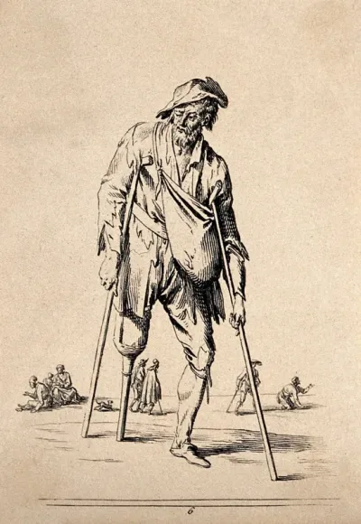 An old man on crutches with a wooden leg