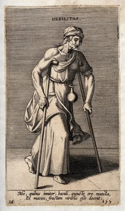 An old woman with a flask attached to her hip moves with the aid of two crutches; illustrating weakness