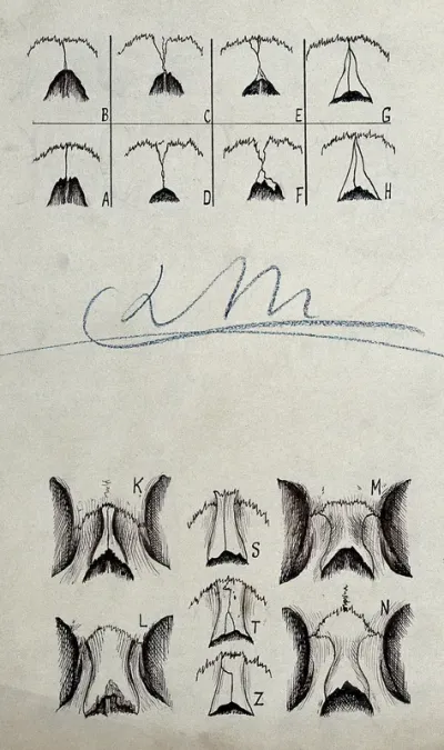 Anatomical drawing (details) by Léonce Manouvrier, ca