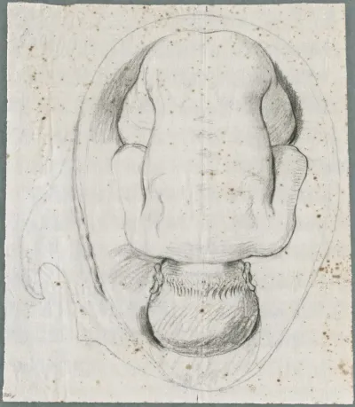 Anatomical drawings: full-grown foetus in the womb