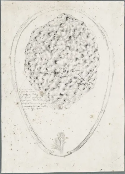 Anatomical drawings: inside view of the pregnant womb
