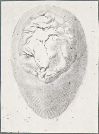 Anatomical drawings: outside view of the pregnant womb