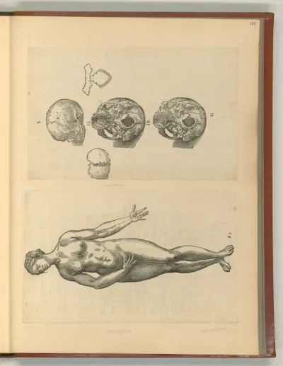 Anatomie des menschlichen Körpers (Frau); Schädelknochen